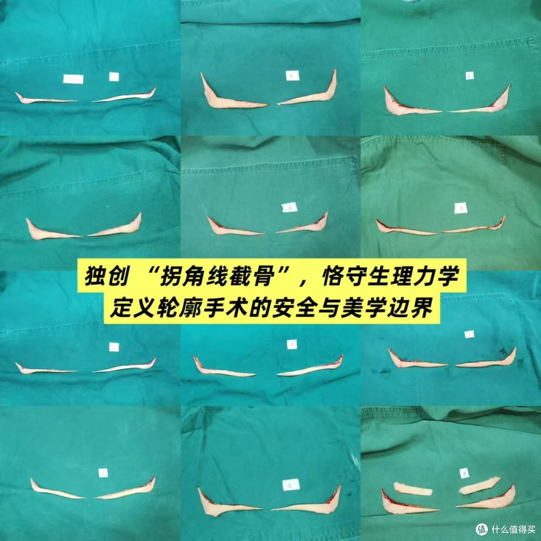 引领“骨相革命”:郭军教授以“悄悄变美”哲学,重塑高级抗衰