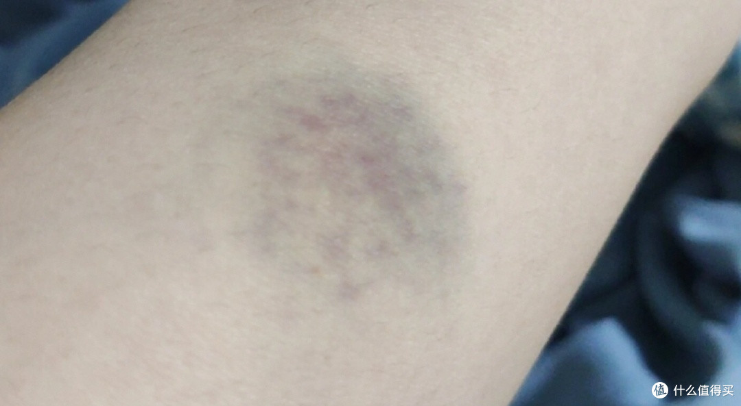 筋膜枪的作用有哪些?警惕五大风险危害,肌肉放松避雷宝典速看