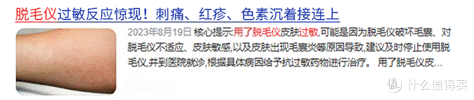 脱毛仪危害大吗?爆料五大坏处,避开智商税选品指南