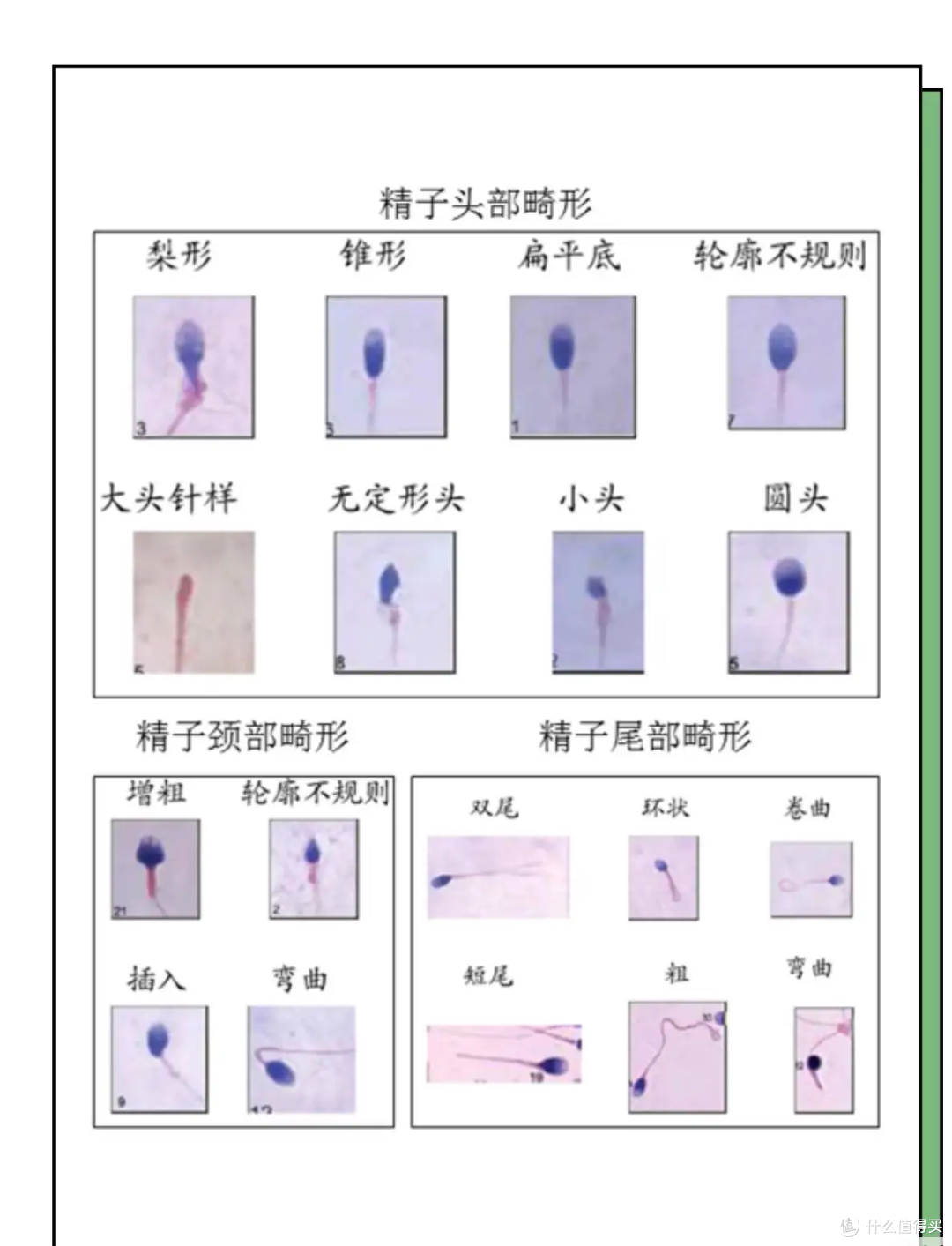 小蝌蚪大危机!全球男性精子质量变差,可能影响寿命和智商