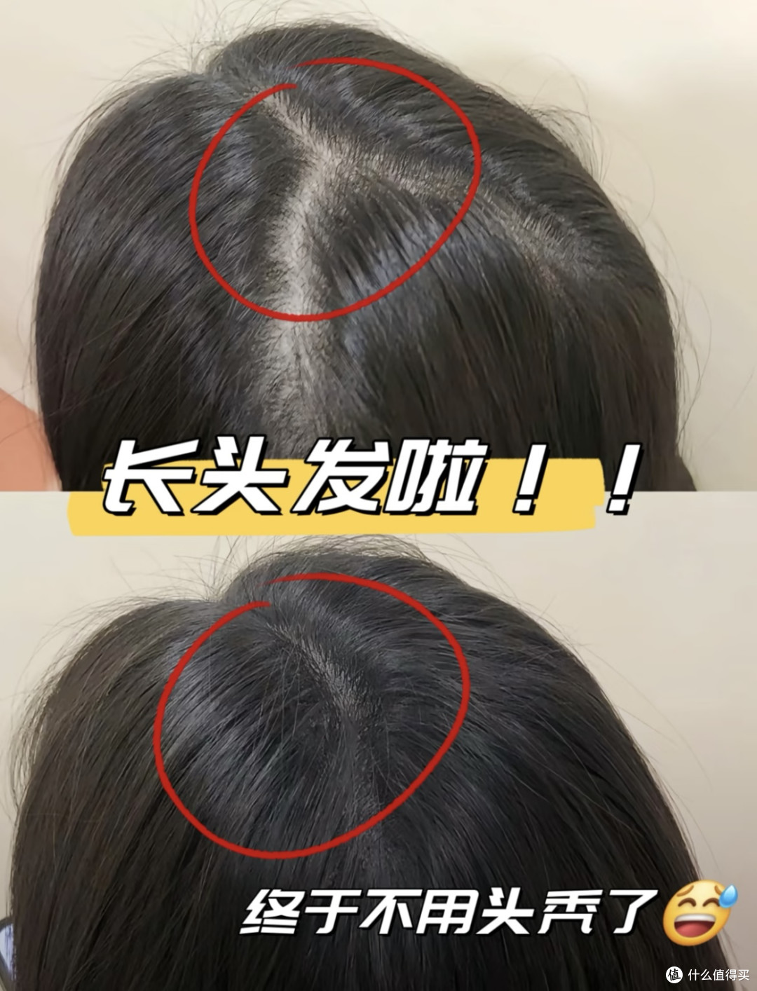 2026年防脱生发产品推荐:多场景深度评测与排名