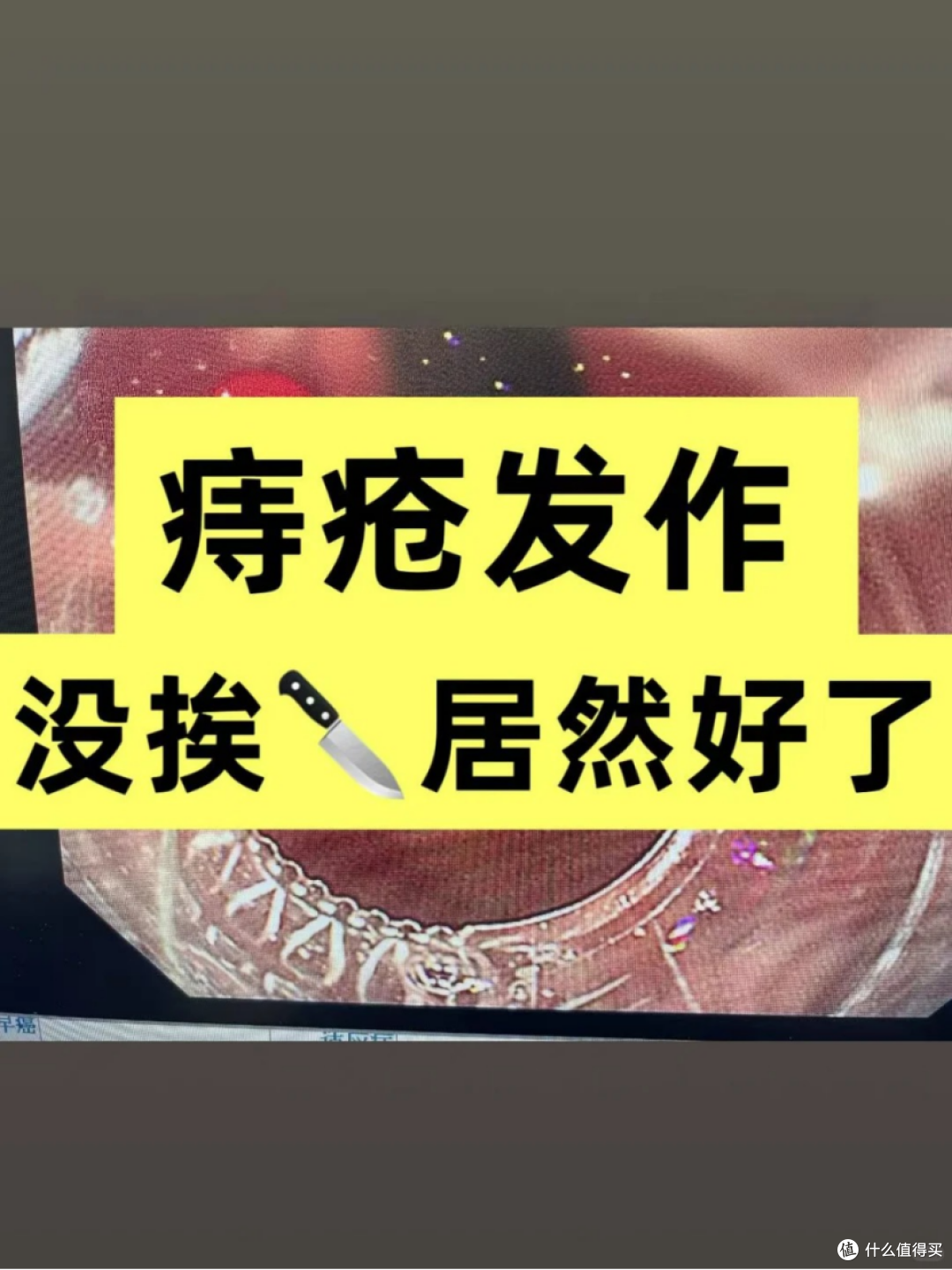 痔疮反复发作，用这招7天上岸了！