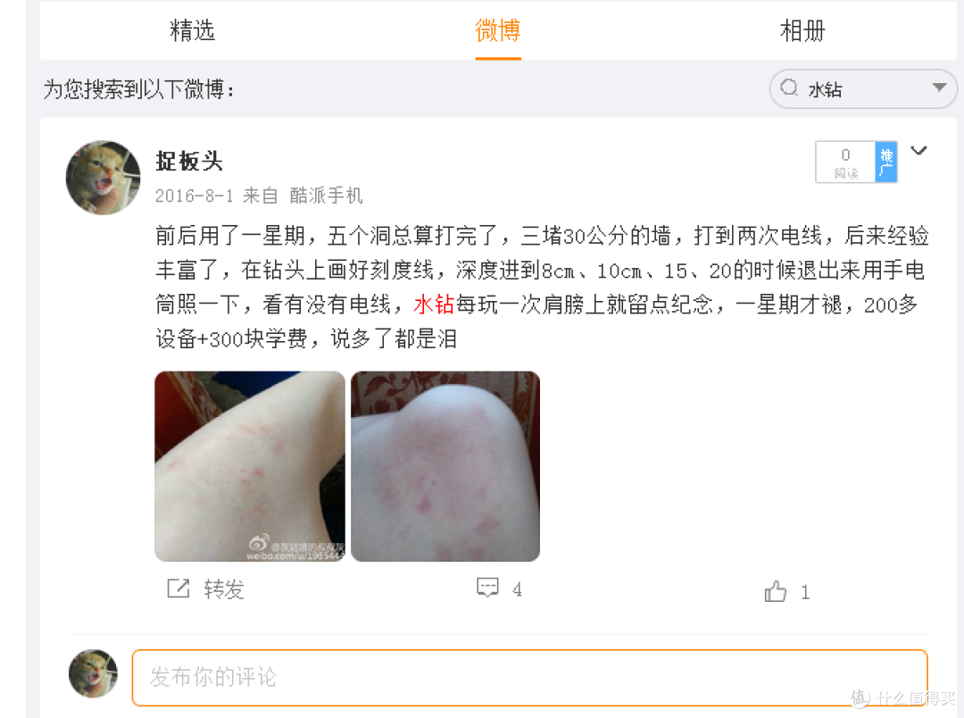 而每次打完洞，身上都会留下点记号，要一个礼拜才褪掉