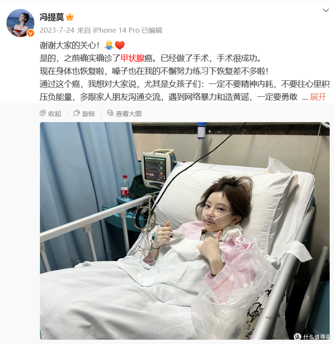 冯提莫素颜晒甲状腺手术疤痕，直言：这是老天给的美丽微笑线！