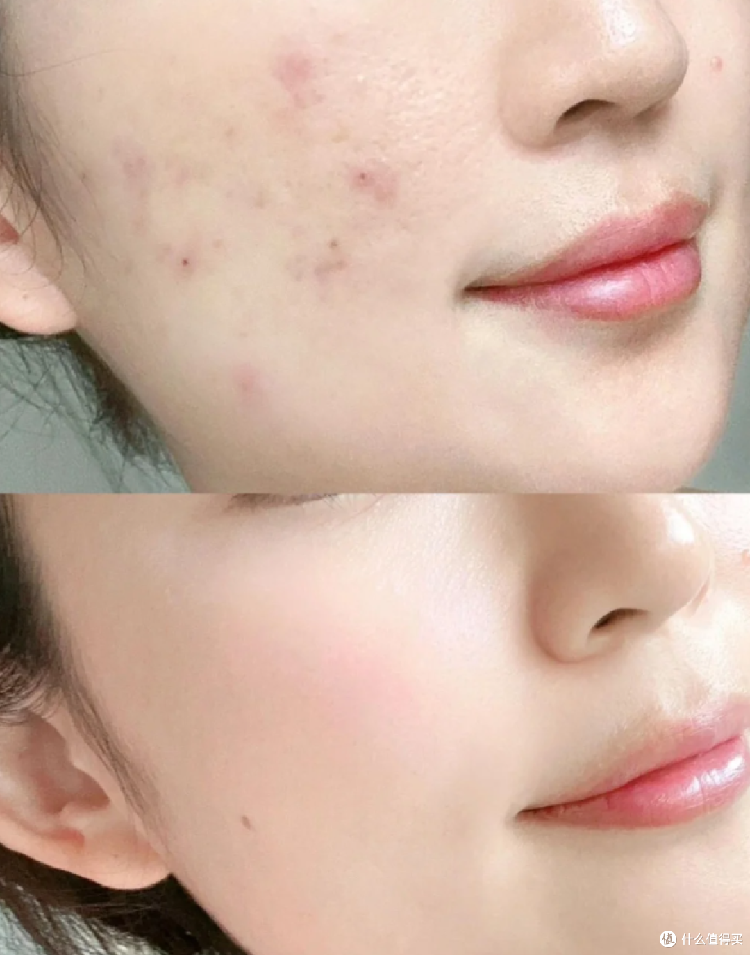 什么洗面奶祛痘?洗面奶品牌排行榜前十名秘诀揭晓,拯救痘痘肌