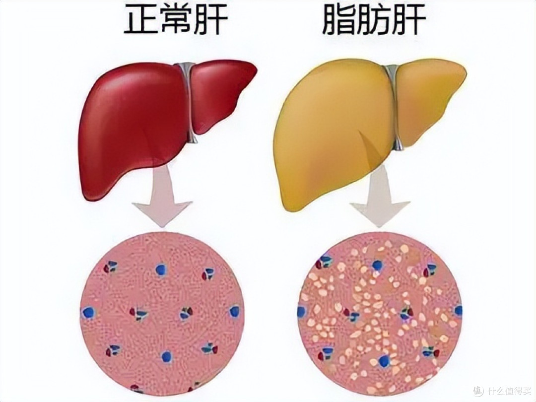 健康的“隐形杀手”——肥胖,危害为什么那么大?