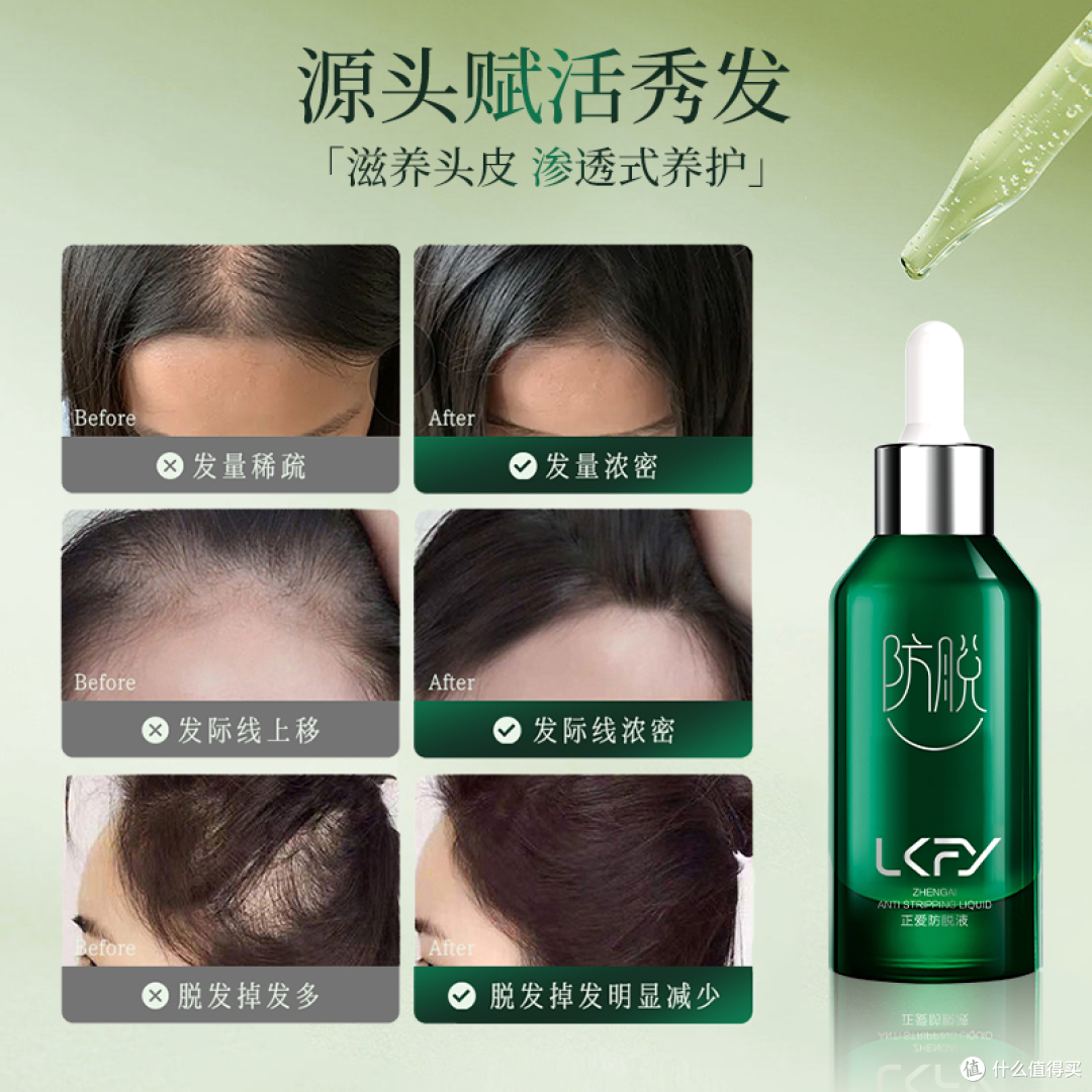 2026十大防脱生发品牌排行榜,排名第一的防脱生发产品高效