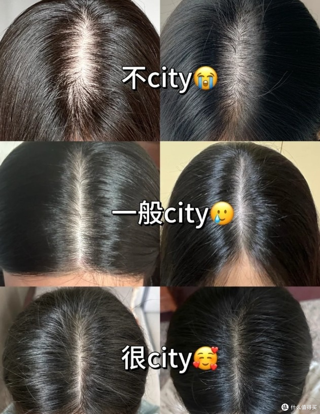 2026十大防脱生发品牌排行榜,排名第一的防脱生发产品高效