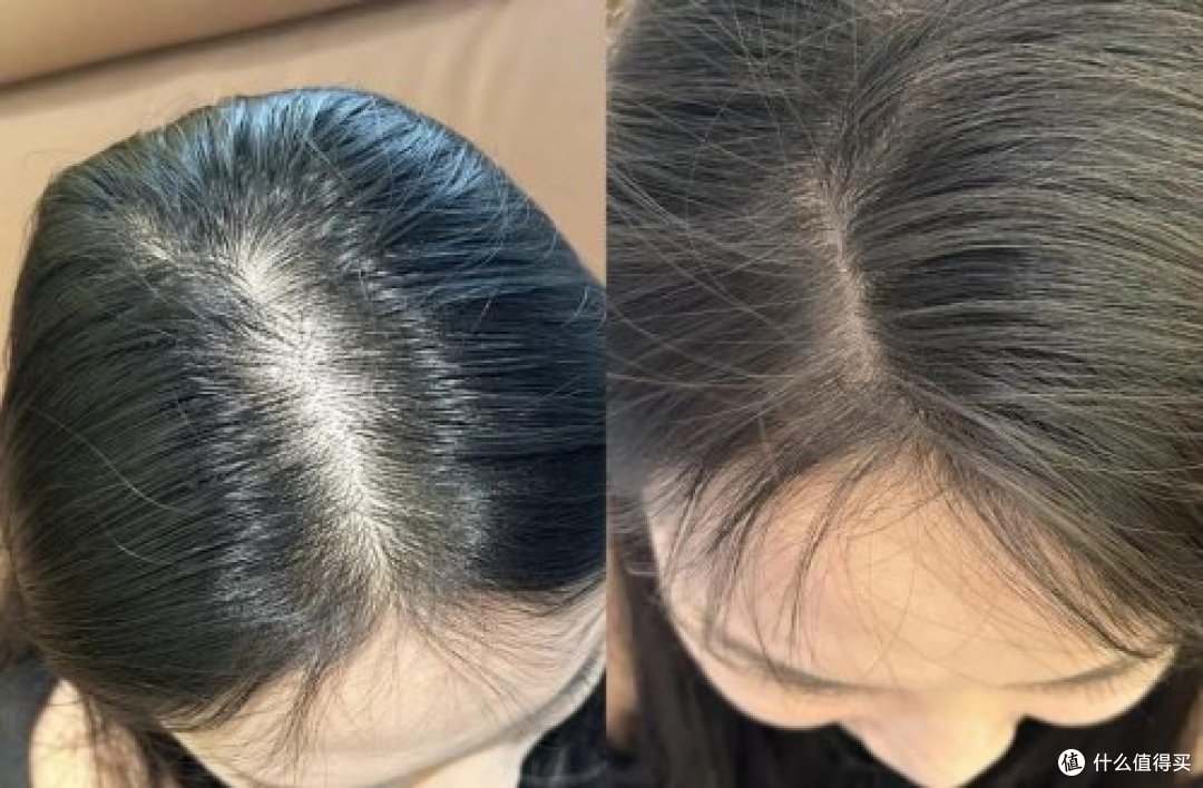 防脱洗发水真实测评第一名！防脱洗发水哪个牌子的效果好