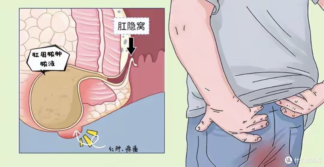 你有“洗屁股”的习惯吗？提醒：经常清洗肛门，或可带来3种好处