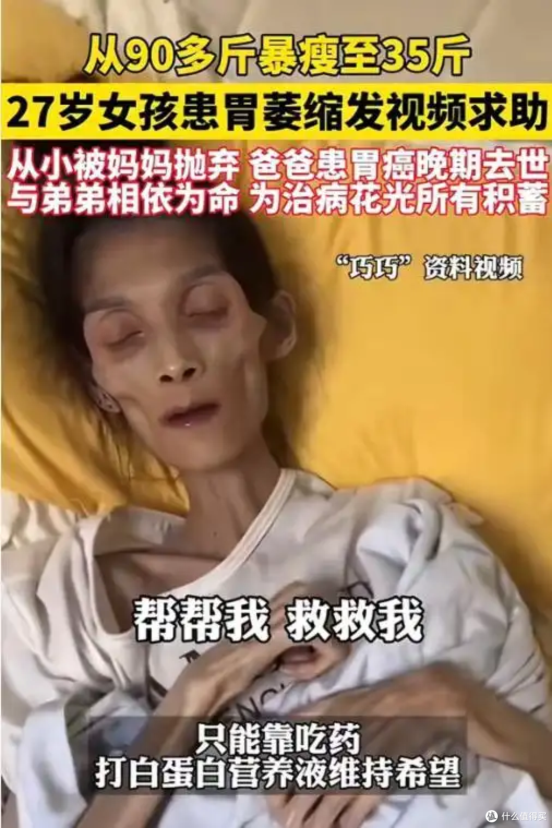 27岁女孩患胃萎缩离世，体重仅35斤，这些胃病信号要警惕