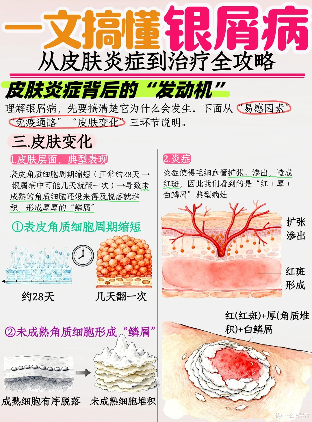 一文看懂银屑病,真不是“皮肤病”那么简单