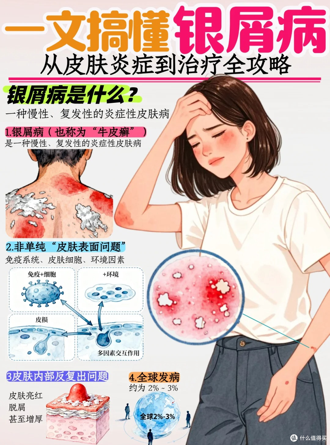 一文看懂银屑病,真不是“皮肤病”那么简单