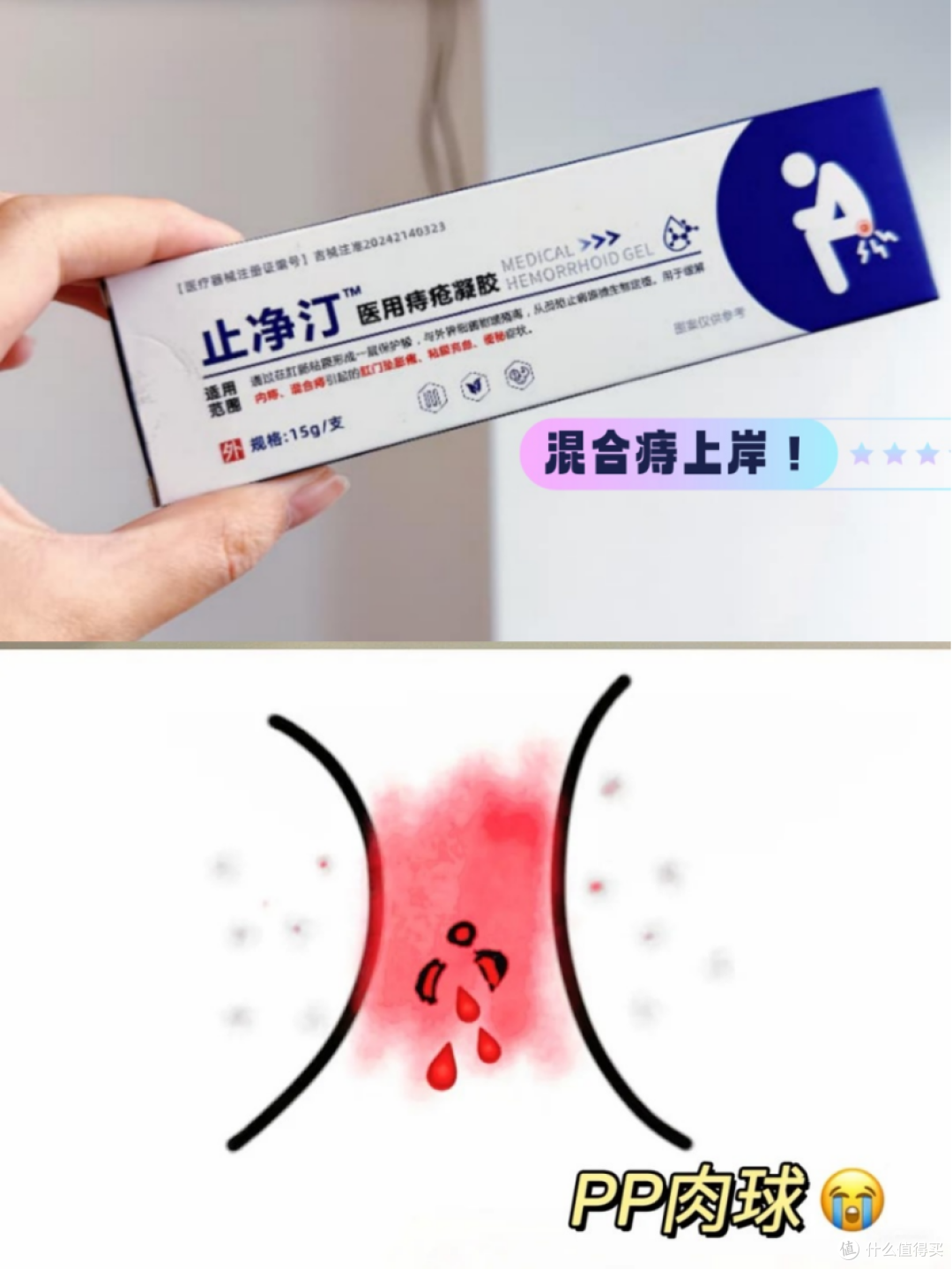 用痔疮膏消肉球28天,真实体验分享!