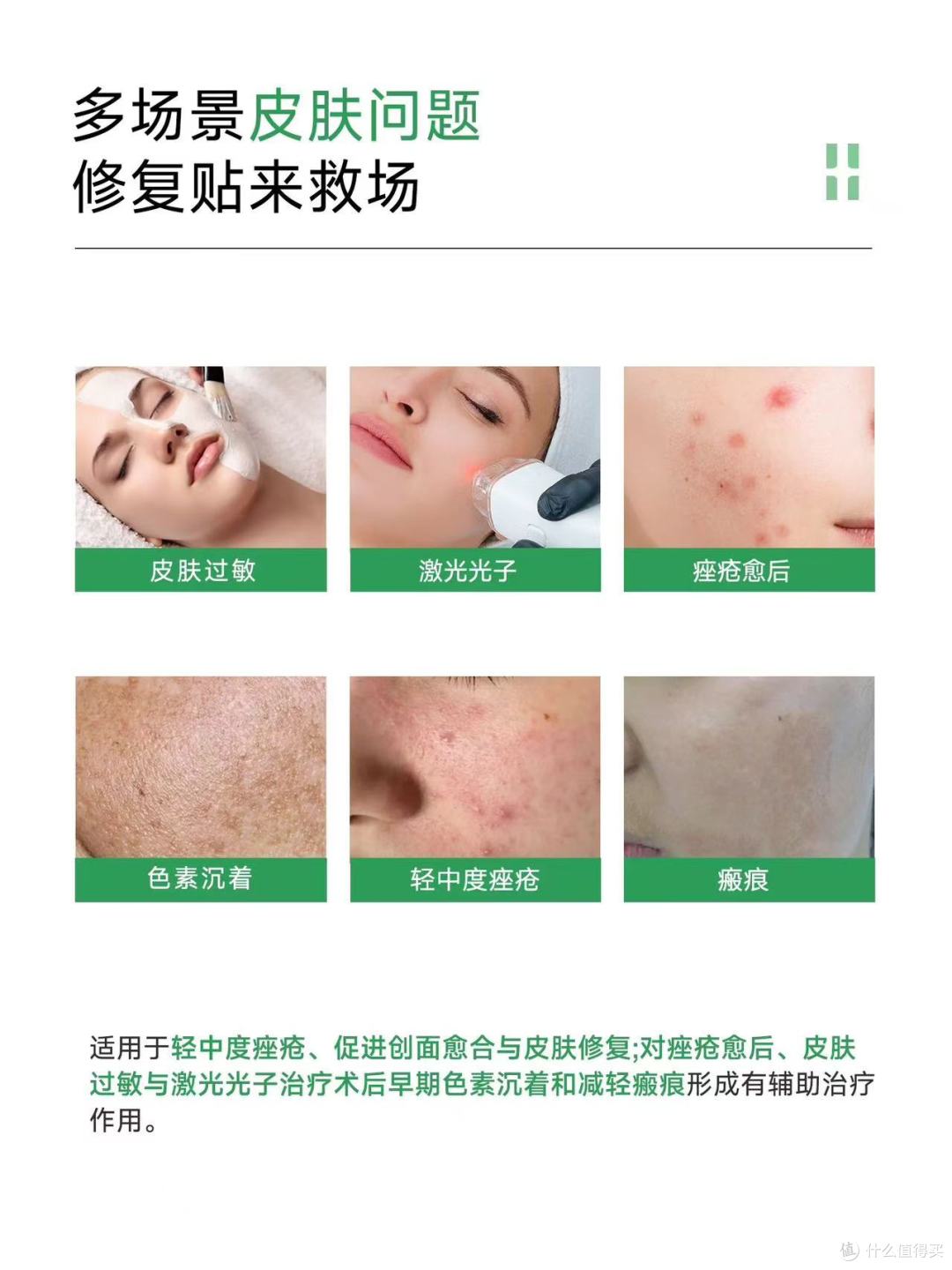 术后创面+皮肤过敏救星✨ 这款修复贴我能无限回购