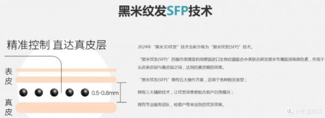 秃头还能植发吗?2026年脱发改善新选择:纹发与植发的抉择指南