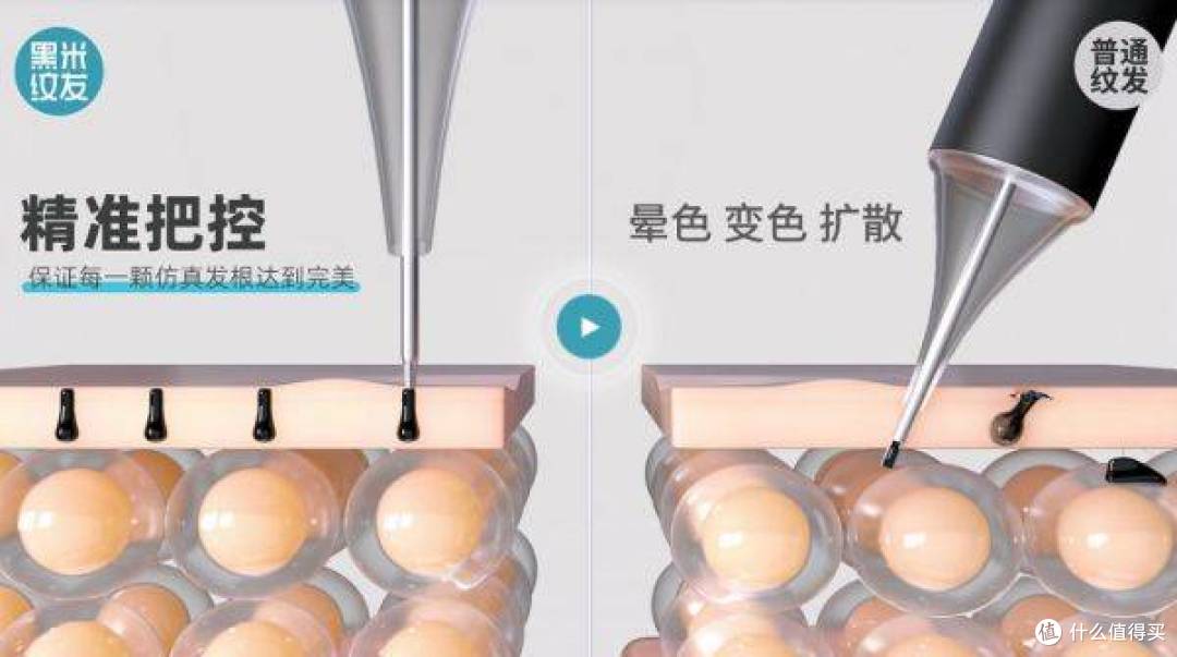 沈阳植发避坑指南｜美发博主实测：纹发比植发更省心