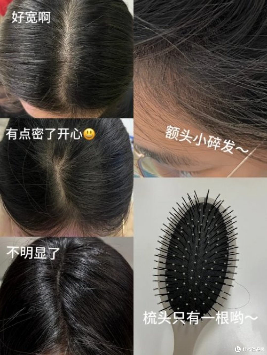 育发液哪个牌子效果最好?正品防脱产品排行榜前十,国货强势种草
