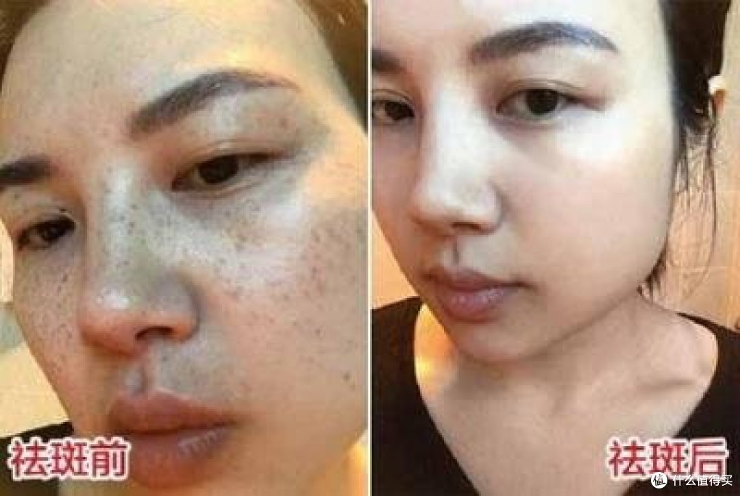 什么牌子美白去黄效果好?祛斑效果最好的排名第一,国货品牌可靠