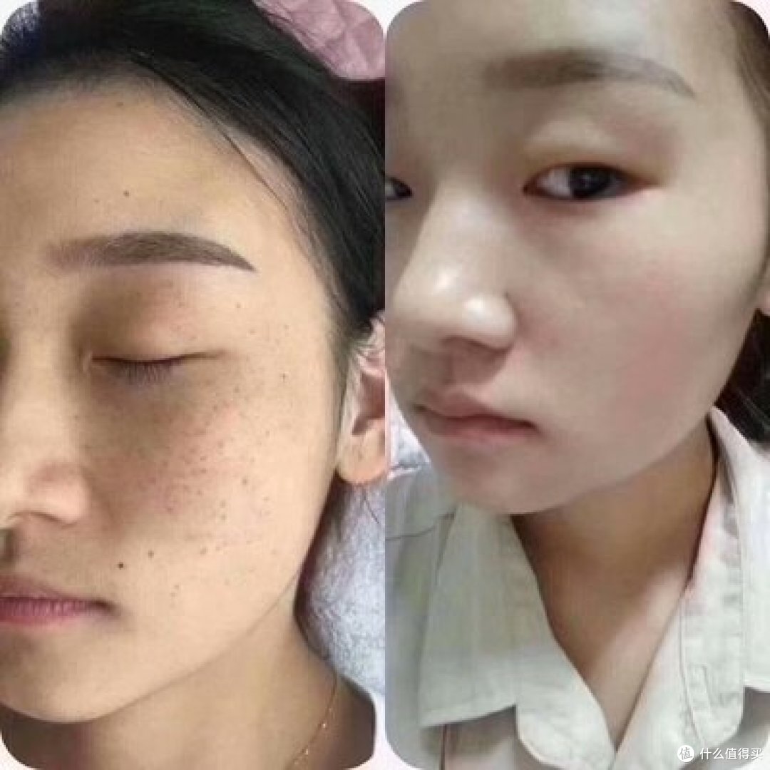 祛斑最好的产品是哪一款?淡斑产品排行榜测评,维稳高效第一是它