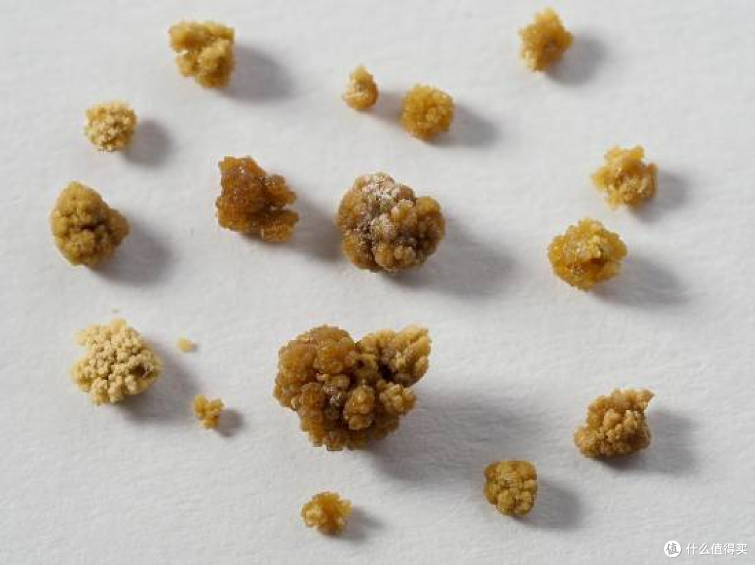 笨贼翻窗偷“黄金”,失主笑喷:那是我刚取的肾结石,给你个教训
