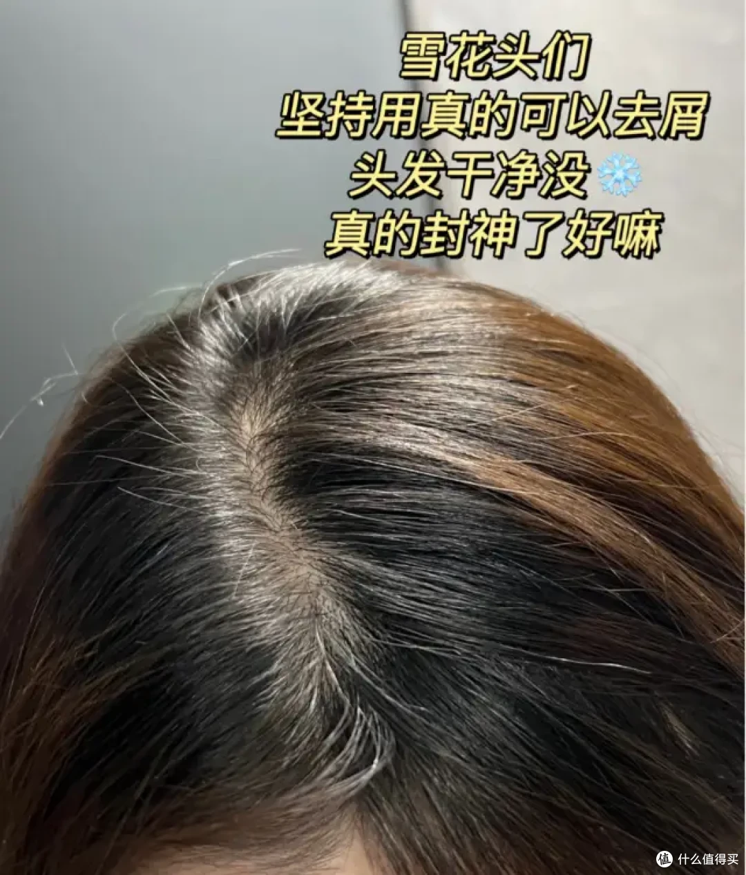 去屑控油洗发水怎么选才靠谱?选购技巧 + 真实测评,少走弯路