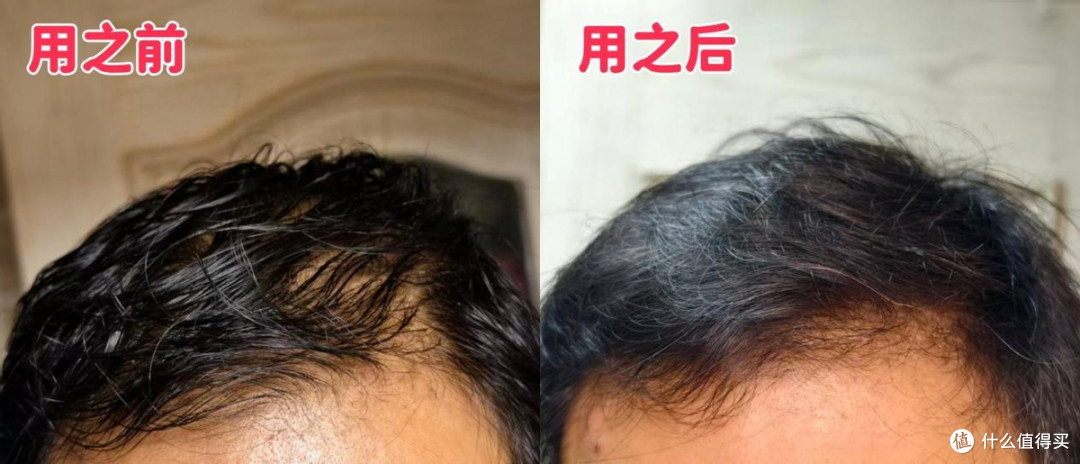 中年男人清爽控油三件套分享，这么好的宝藏产品知道太晚了！