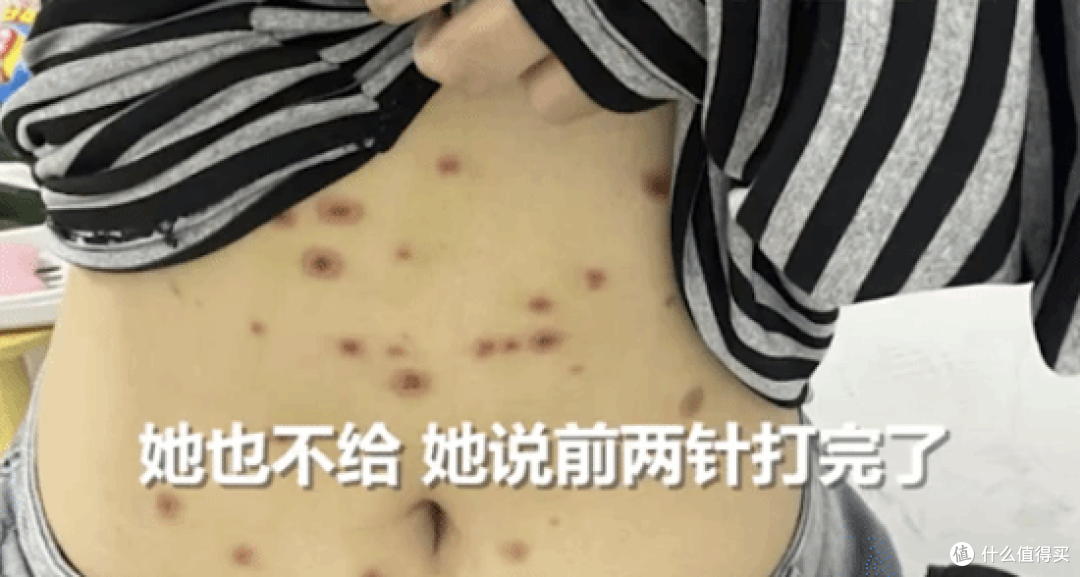 800元买猫竟踩大坑!全身长猫藓,治疗花近千比猫还贵!