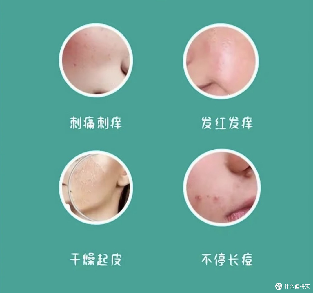 春季皮肤过敏高发?5个“抗敏绝招”,让你远离红肿痒!