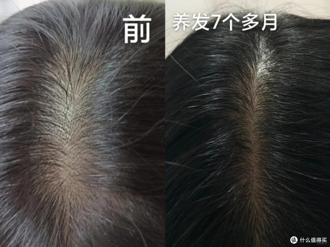 公认防脱洗发水!2026哪个牌子最有效?国产靠谱防脱洗发水品牌