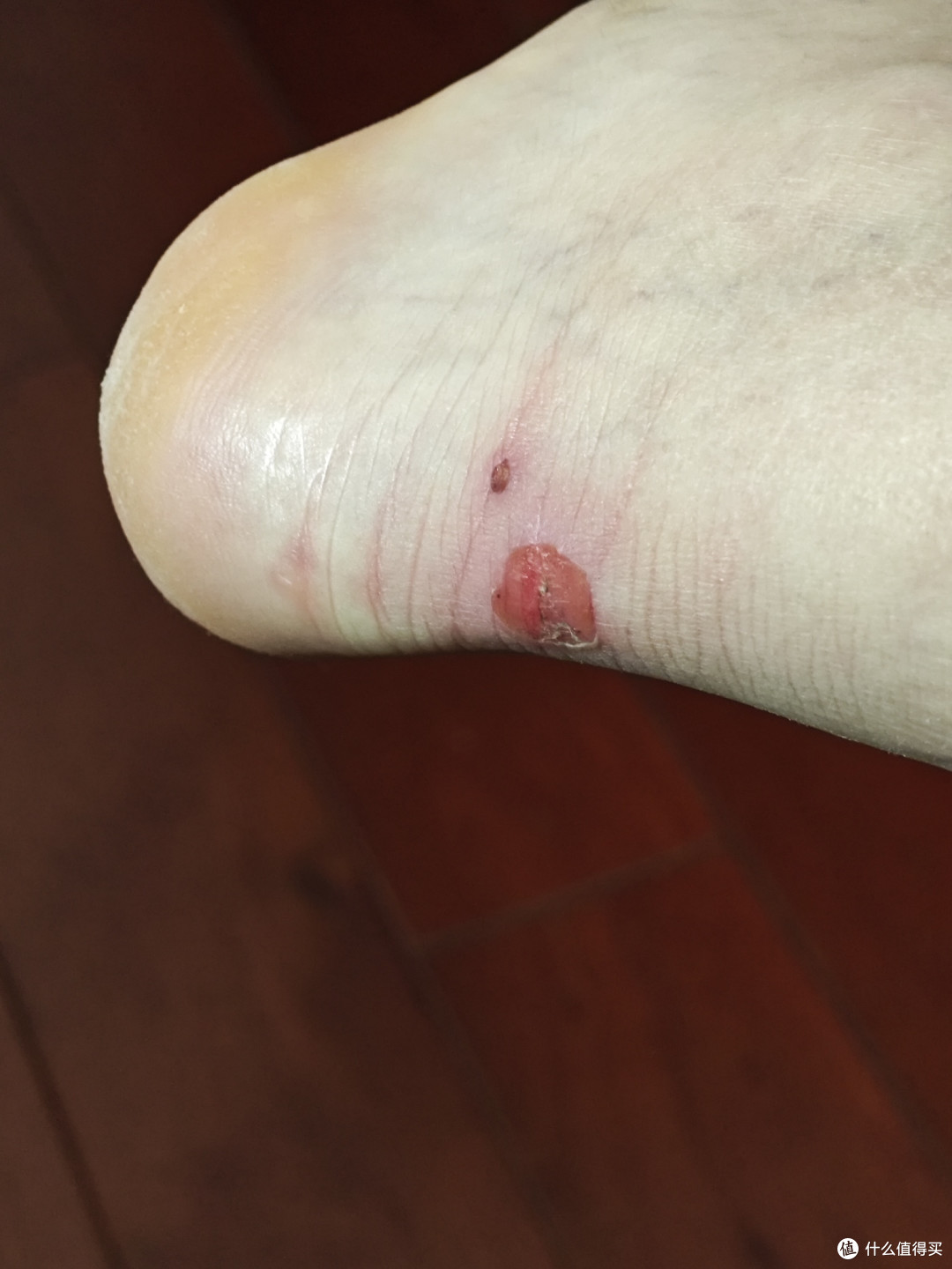 选跑步鞋,一定要选择专业的必迈跑鞋。特步的会把脚后跟磨破。