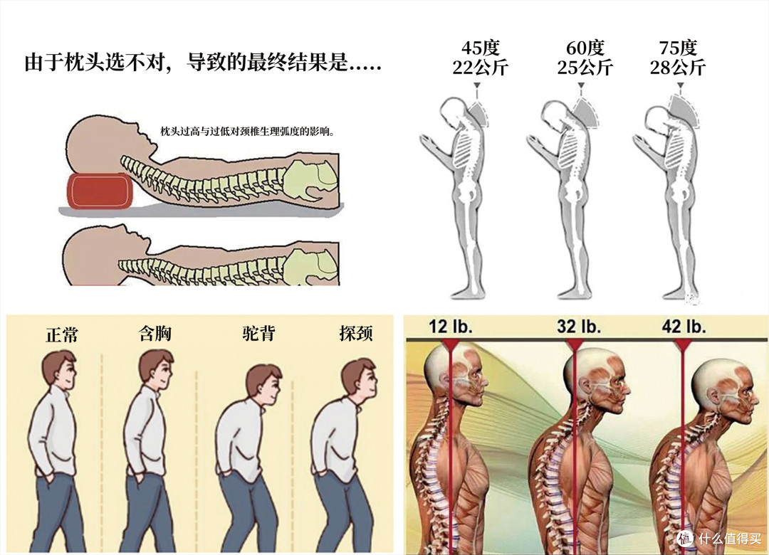 颈椎不适