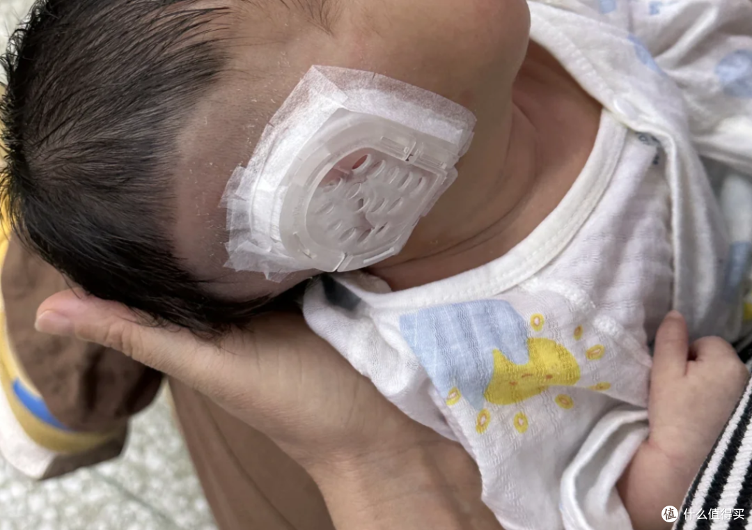 娃耳朵矫形花1万2值吗?医生坦言:这钱省了,将来可能花10万!