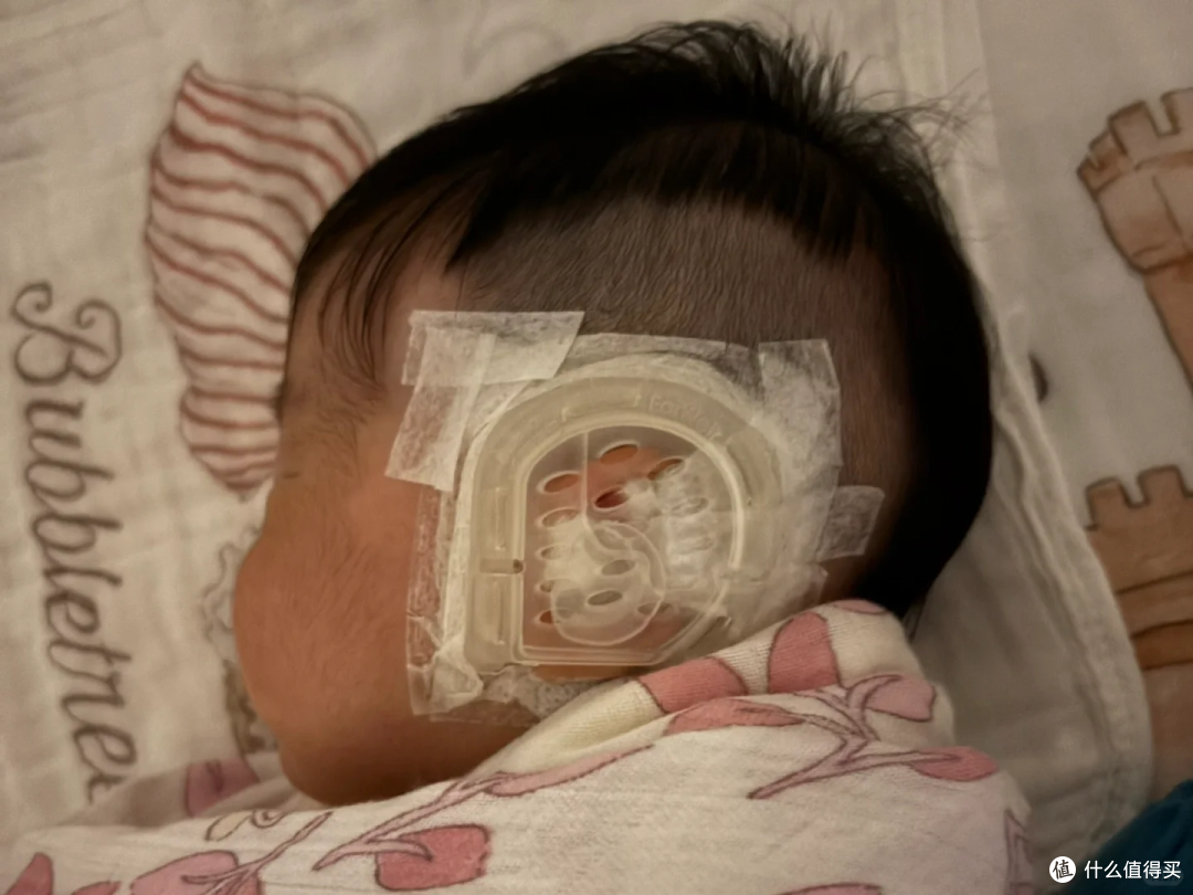 娃耳朵矫形花1万2值吗?医生坦言:这钱省了,将来可能花10万!