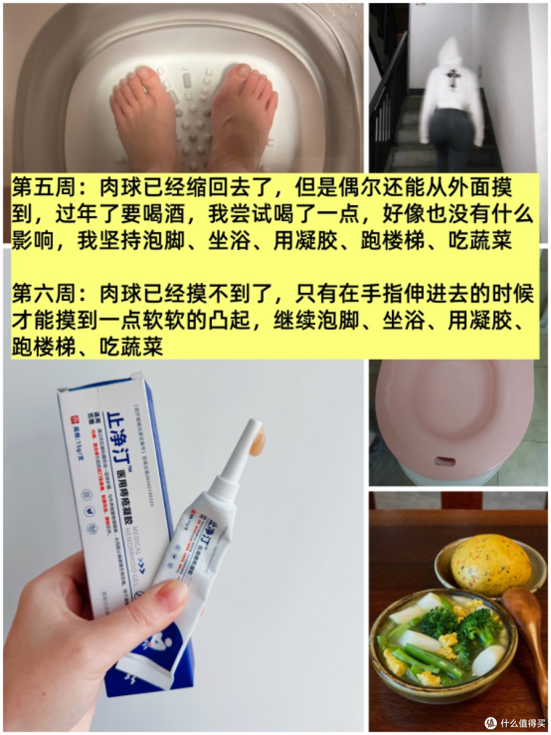 让痔疮肉球自动消失的7周