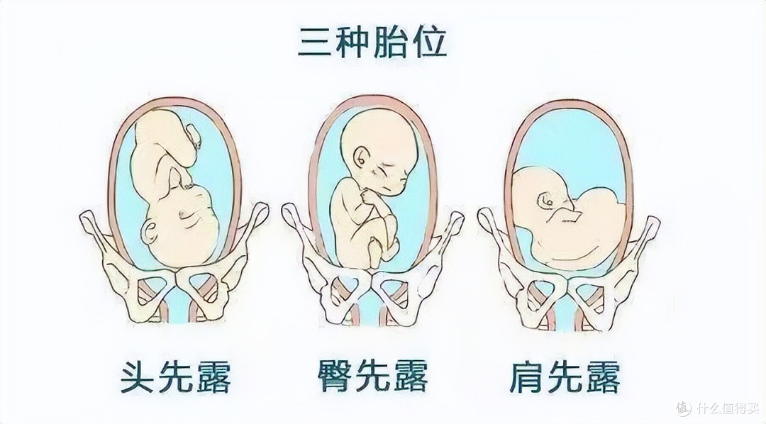 宝宝出生时为什么是头先出,而不是脚先出?实在是宝宝太聪明了