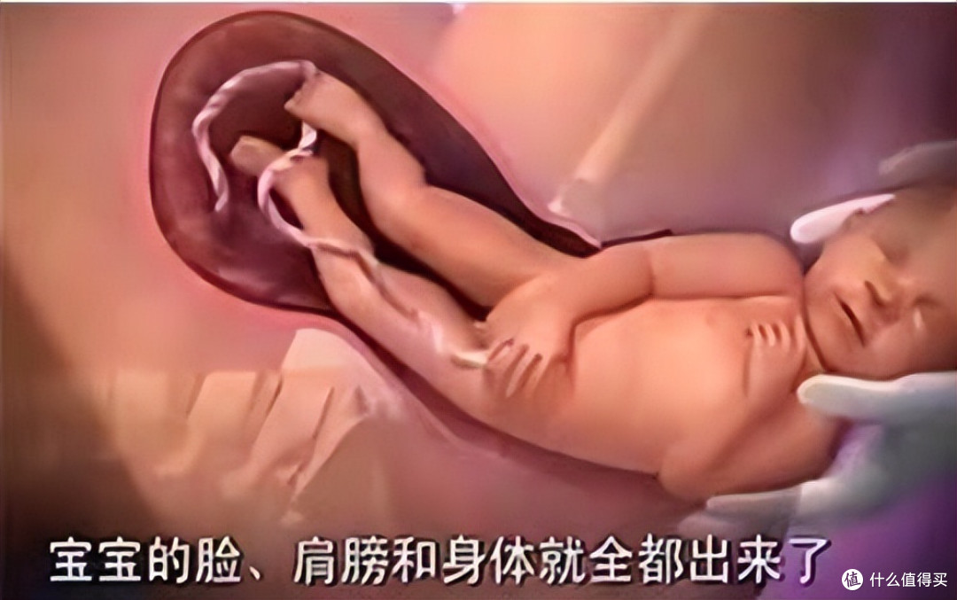 宝宝出生时为什么是头先出,而不是脚先出?实在是宝宝太聪明了