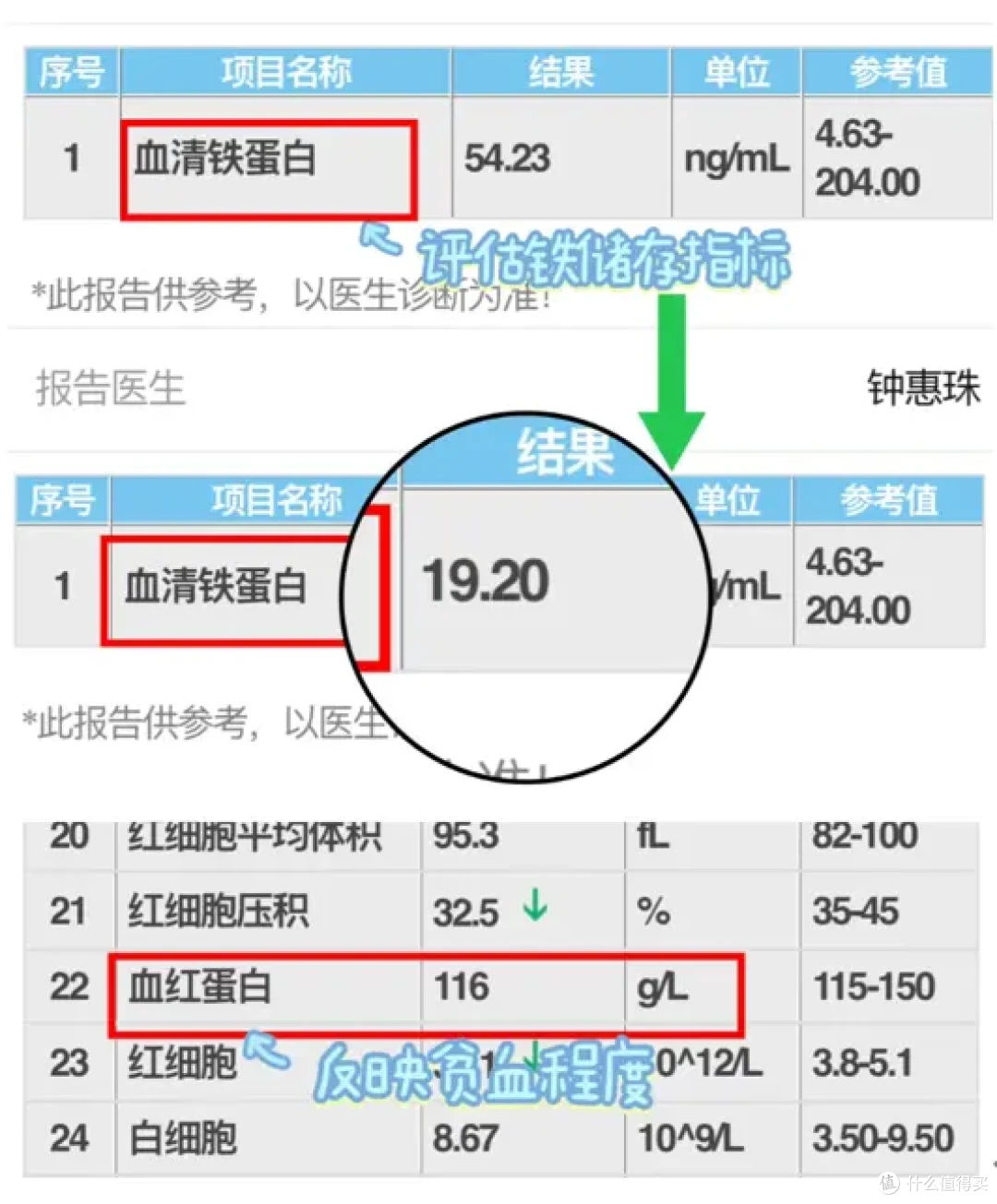 孕妈身体出现这些信号当心是缺铁性贫血!补铁不只是食补