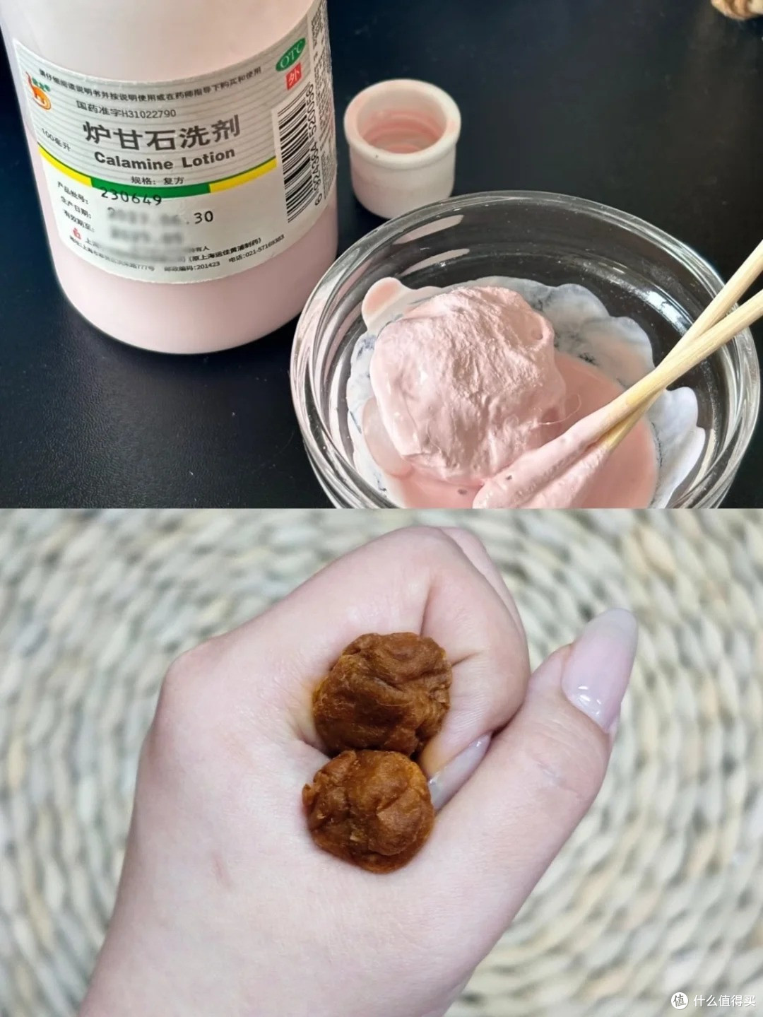 肛裂和痔疮有什么区别?到底该怎么护理!
