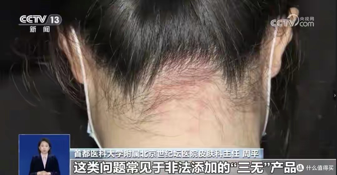 警惕“速效美白”陷阱:汞超标化妆品——美丽背后的慢性毒药