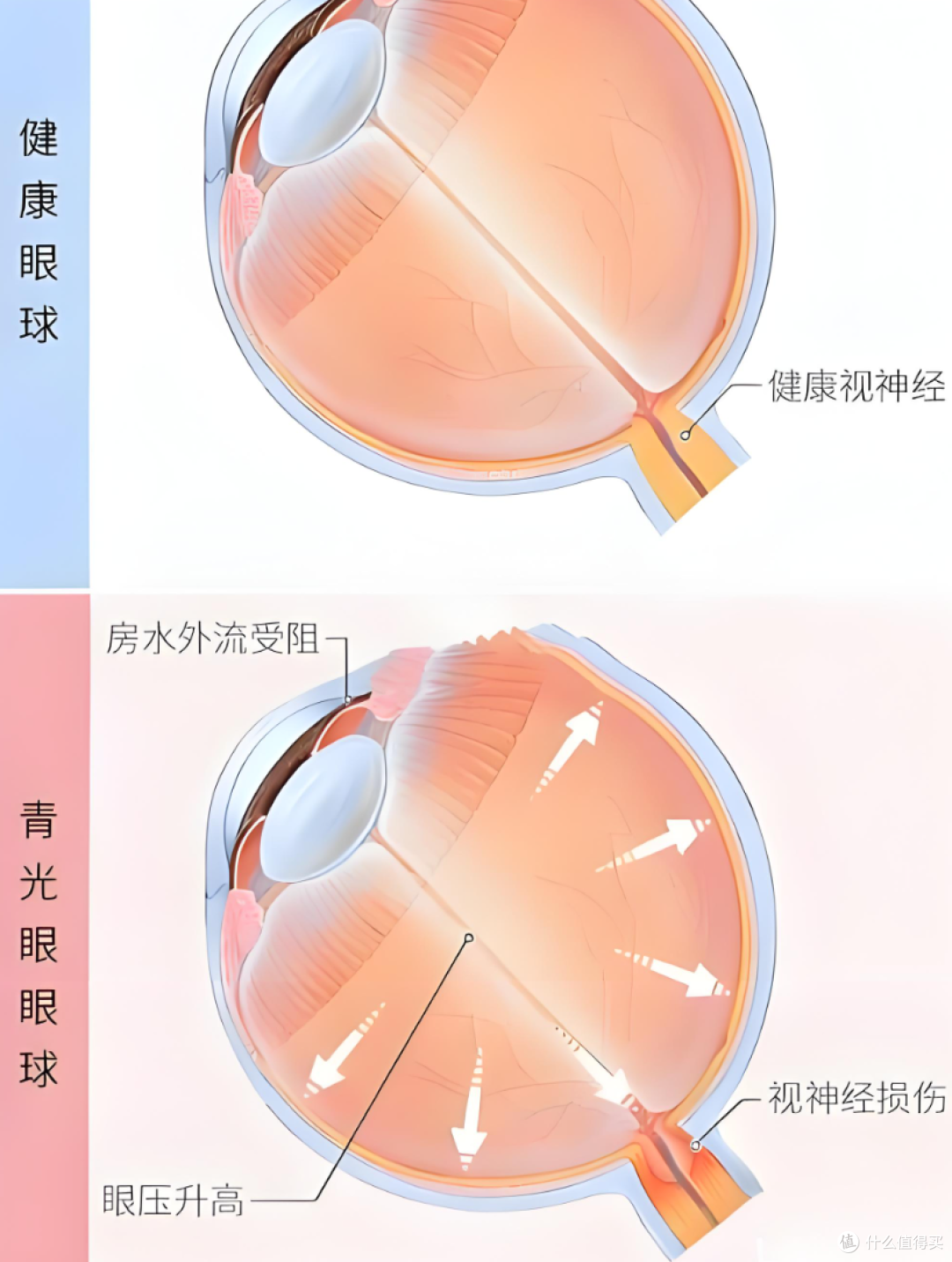 省电!父母关灯刷手机等于毁眼,医生:这 3 个习惯正在偷走视力