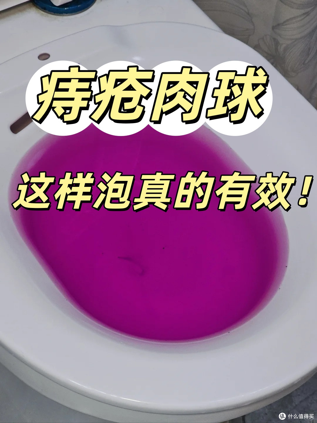 才知道坐浴这样泡,对痔疮肉球真的有效!