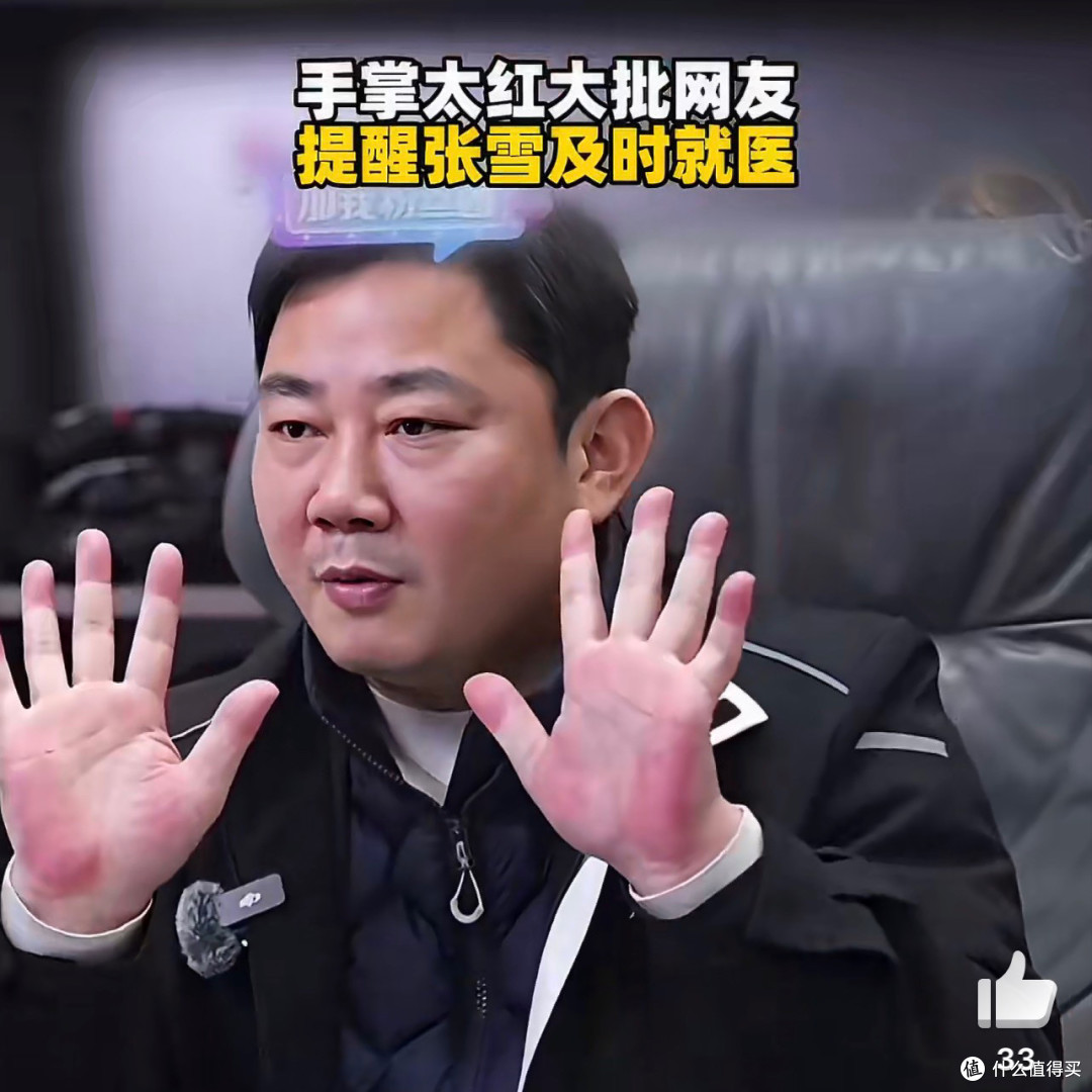 张雪掌红疑肝掌,网友提示及时就医, 别像张雪峰唇紫再酿悲剧
