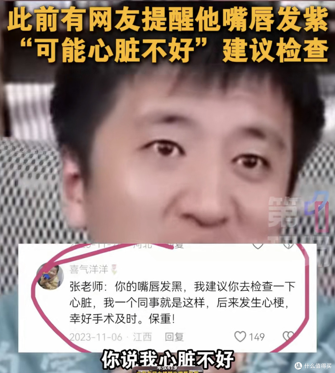 张雪掌红疑肝掌,网友提示及时就医, 别像张雪峰唇紫再酿悲剧