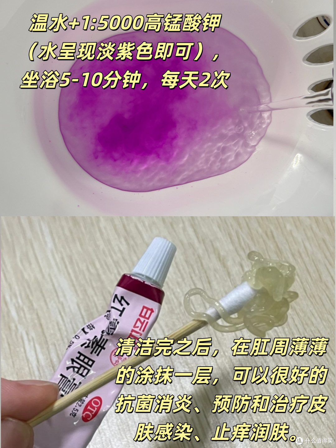 痔疮经历分享：从肉球疼痛到恢复正常
