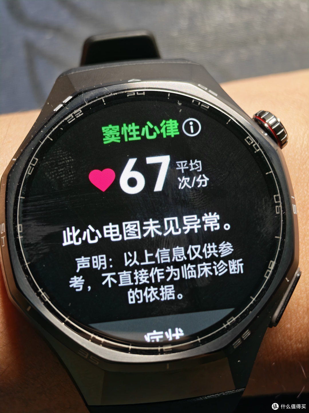30s即可在指尖分析心电图