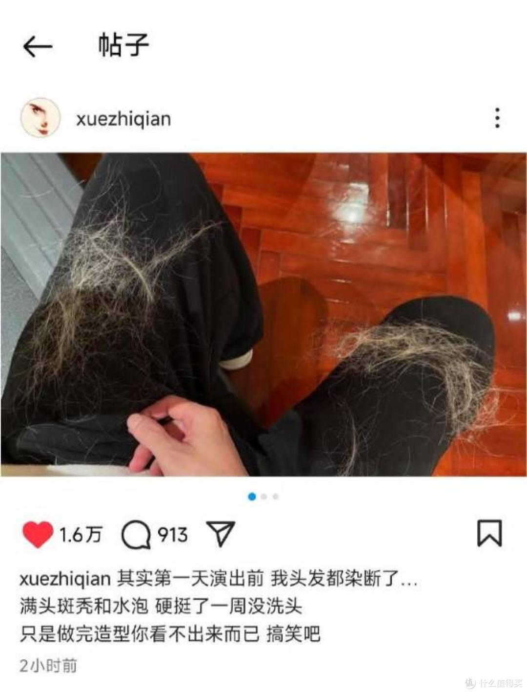 触目惊心！薛之谦自曝满头斑秃水泡，为舞台漂发硬挺一周不洗头！