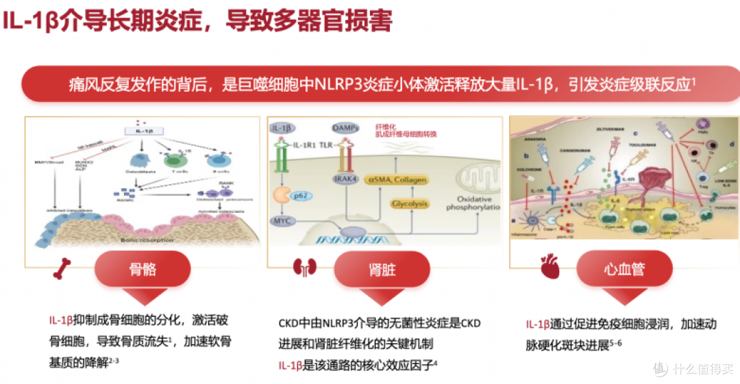 难治性痛风有“特效药”吗?金蓓欣等创新药如何破解治疗困局?