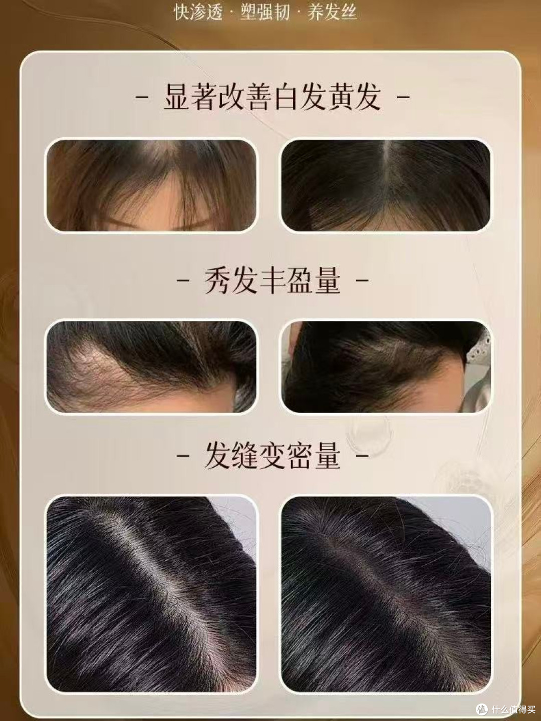 2026 温和洗发皂品牌汇总，洗发皂哪个品牌好？敏感头皮孕妇可用