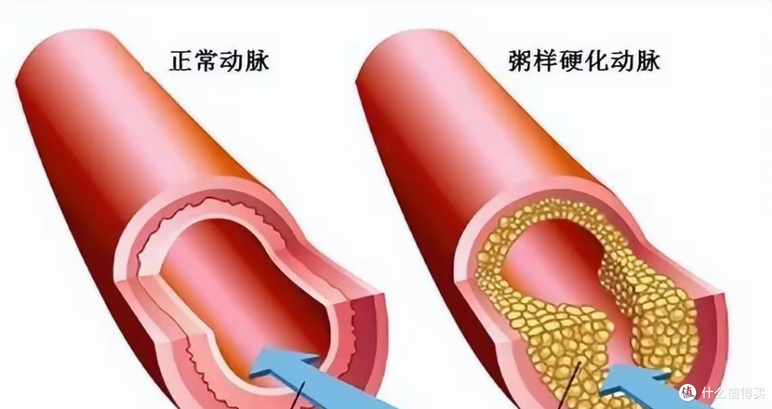 “最佳心率”是多少？过50岁以后，静息心率最好控制在这个范围